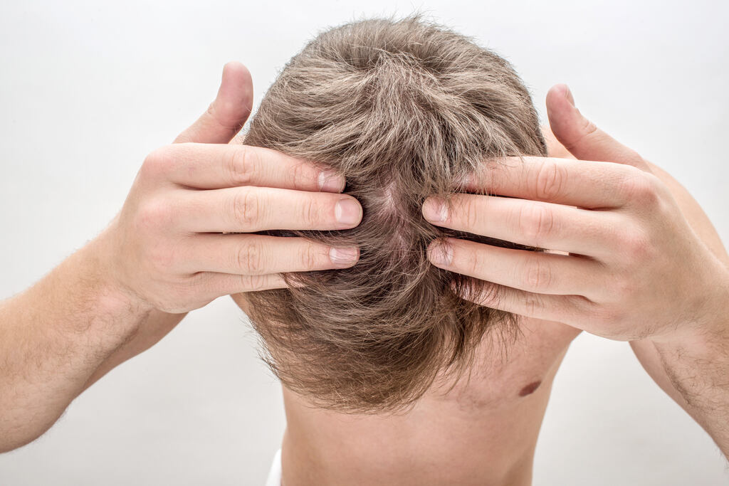 Pessoa identificando que precisa de produto para queda de cabelo